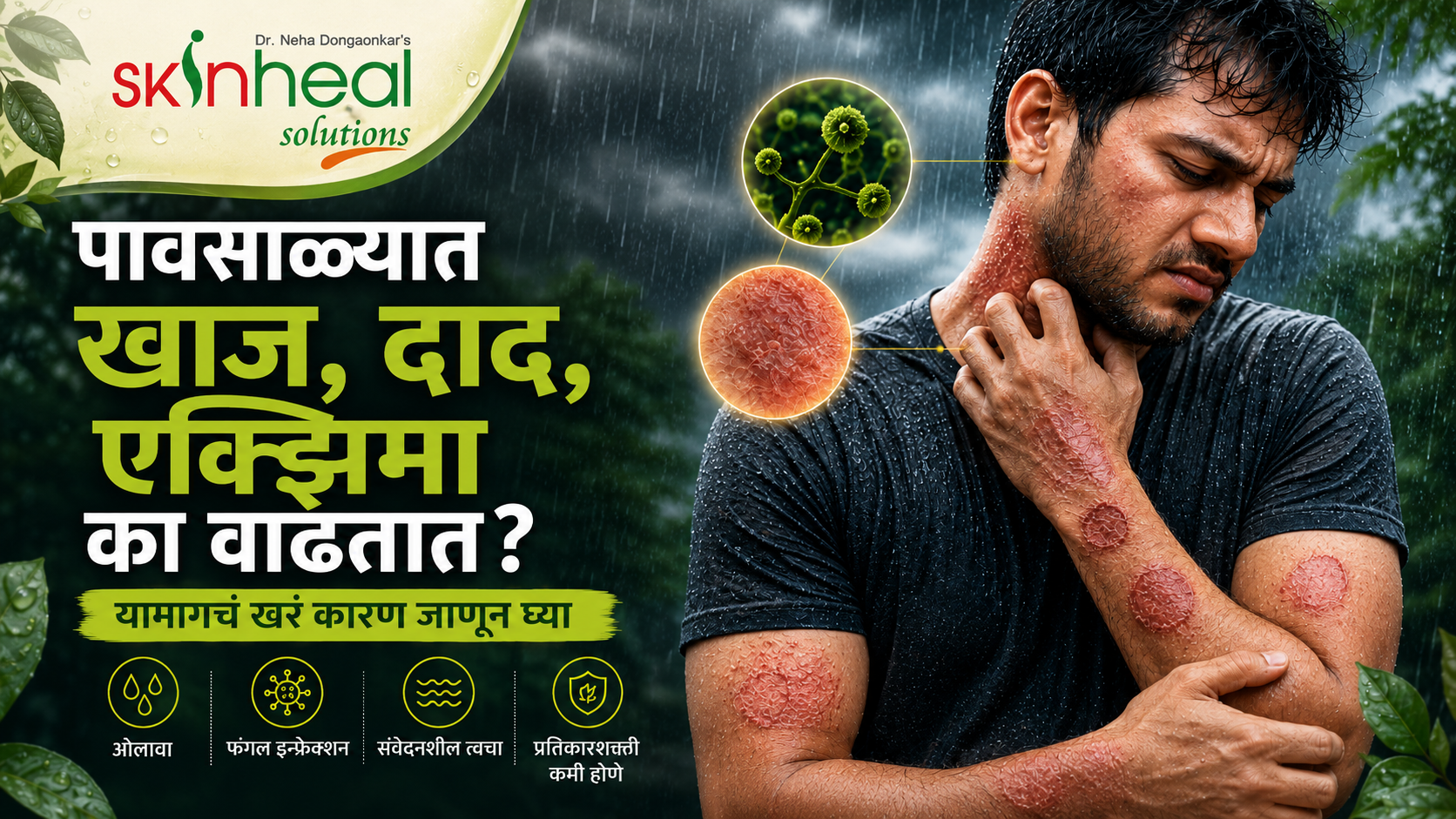 पाऊस सुरू झाला की खाज, दाद, एक्झिमा आणि फंगल इन्फेक्शन अचानक का वाढतात?