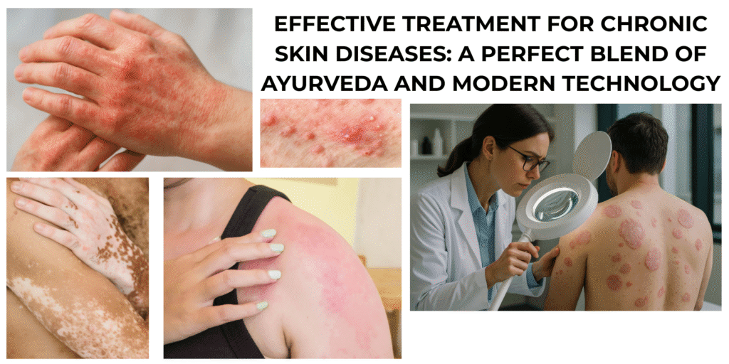 chronic skin condition